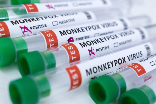 Riverside County Identifies First Probable Case of Monkeypox – NBC Los Angeles