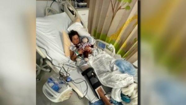 Young Boy Seriously Injured in Bullying Incident, Parents Say – NBC Los Angeles